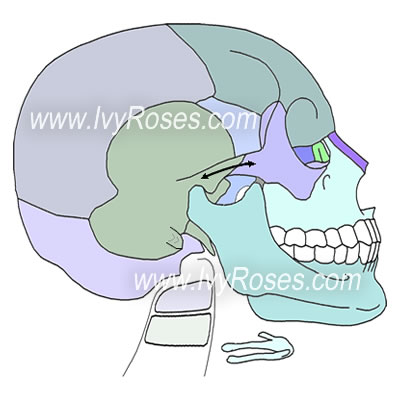 Cranial Facial Bones 118